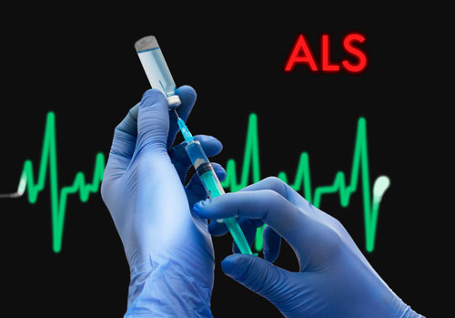 Per Overwegen Uitgaven ALS-behandeling Arimoclomol levert positieve fase II resultaten op | ALS  Liga België vzw