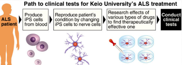 Pad naar klinische testen voor behandeling van Keio University